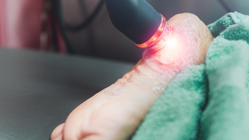 Shockwave Therapy  Oxnard, CA, 